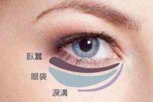 眼袋怎么办 怎么治疗 长眼袋的原因 眼袋的症状 怎么治眼袋 云贝网 眼袋怎么办 怎么治疗 长眼袋的原因 眼袋的症状 怎么治眼袋 云贝网